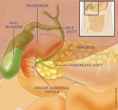 bile duct dilation symptoms